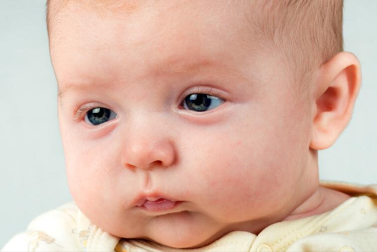 湿疹死皮粘着肉,湿疹粘在衣服上