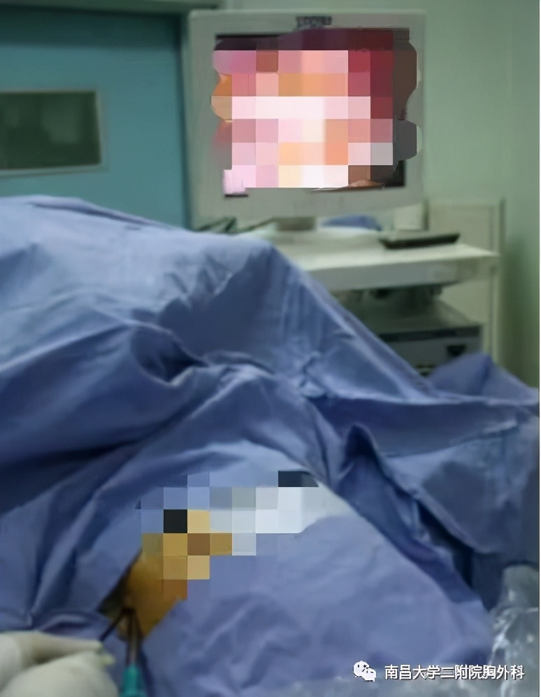 手汗症选哪个医院,手汗症大学科普