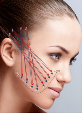 怎么隐藏身上纹,怎么隐藏泪沟法令纹