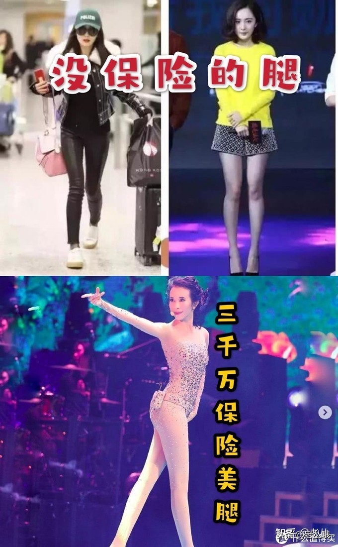 成年后o型腿是什么原因造成的,成人o型腿怎么矫正最有效的方法