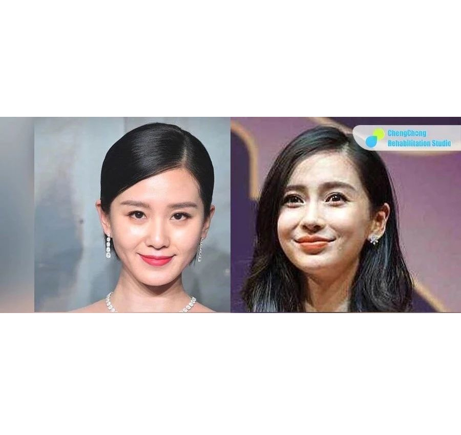 法令纹显老10岁三种方法帮助缓解,有法令纹与没有法令纹显老显凶