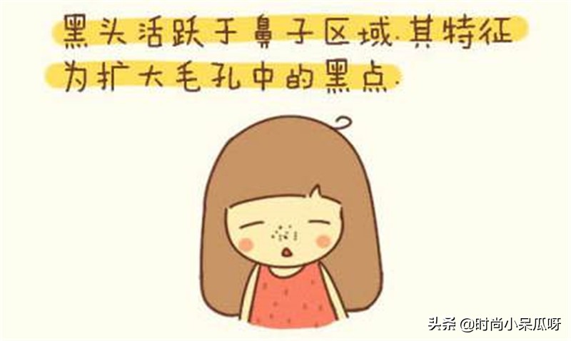 如何有效去黑头并有效修复毛孔,不伤皮肤的去黑头方法
