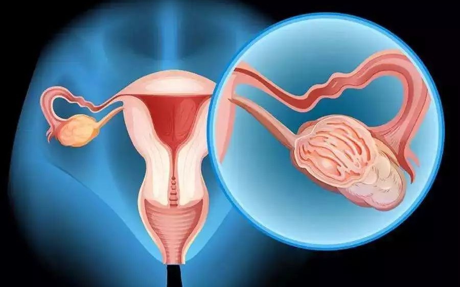 干细胞衰老,衰老造血干细胞