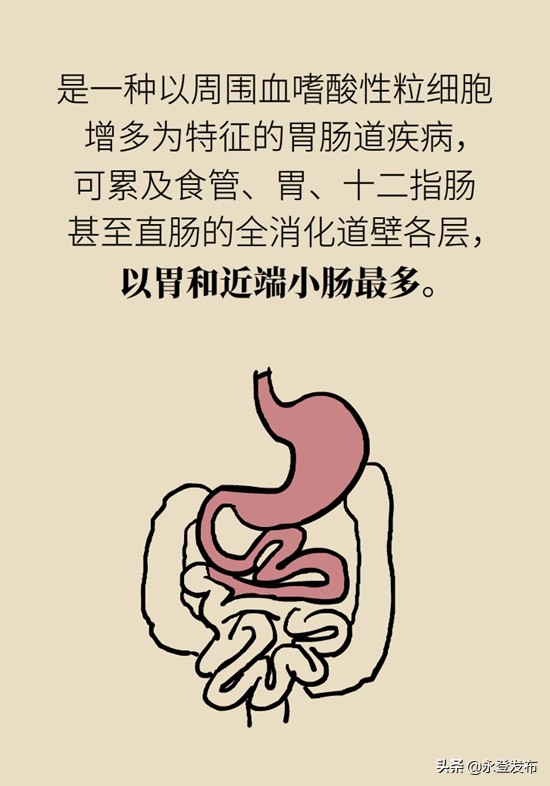 小女孩辣条吃多了肚子痛,吃辣条吃多了腹部绞痛