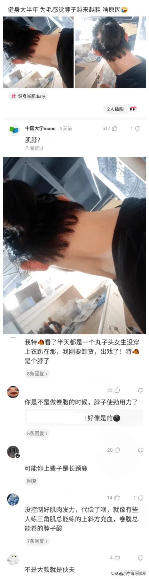 为什么健身后感觉脖子变短了,健身如何避免脖子粗