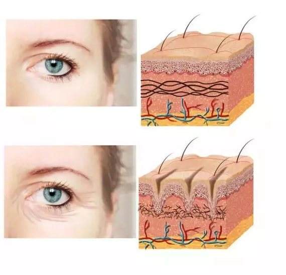 皮肤衰老怎样做抗衰,除皱抗衰哪种方法更适合你呢