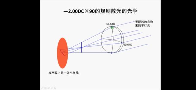 大多数人都是散光,很多人其实都不知道自己散光