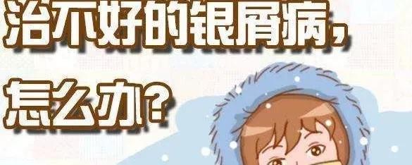 银屑病复发期怎么控制,银屑病复发时怎么控制