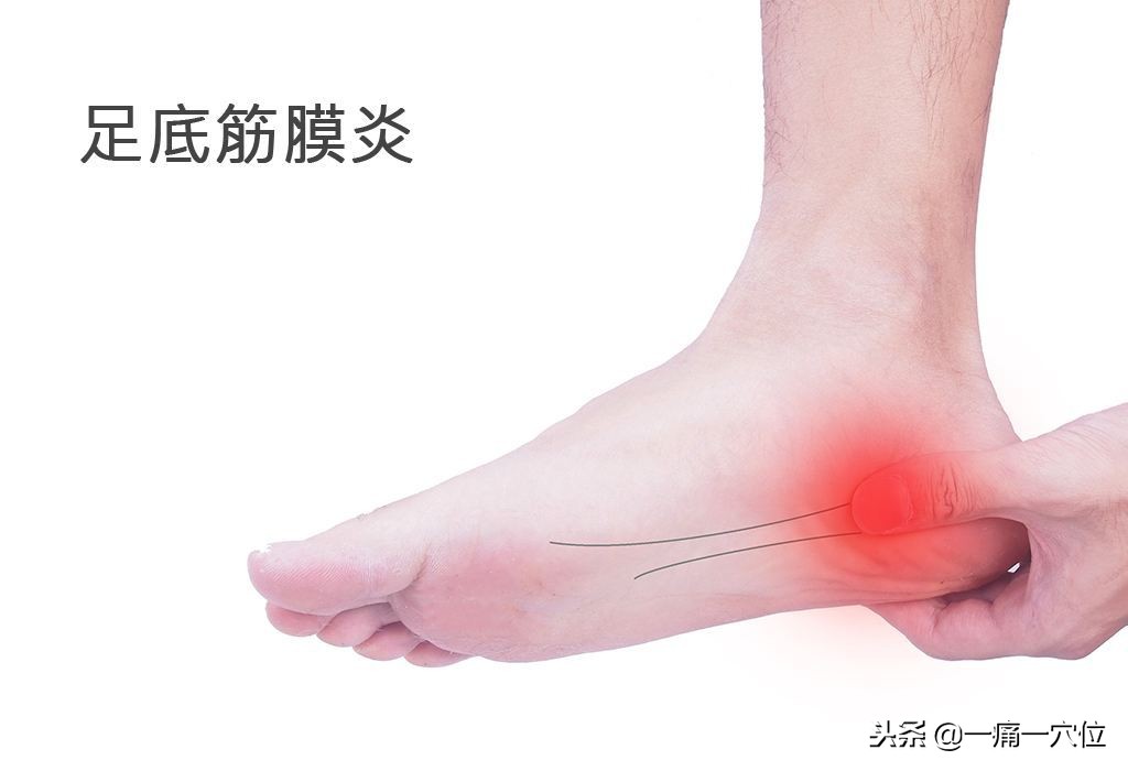 老年足跟痛的治疗方法,老年人足跟痛一招教你解决