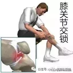 内侧半月板后角损伤怎么治疗,半月板损伤有积液的最好治疗