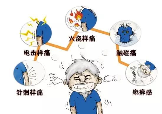 带状疱疹发展过程是怎么样的,带状疱疹怎么发生的