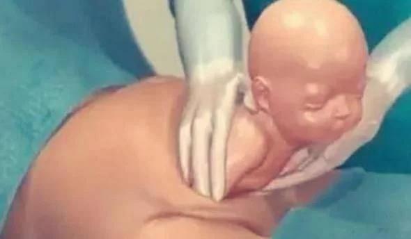 剖腹产仅仅“挨一刀”就完事了?看完四张图,谁说简单和谁急