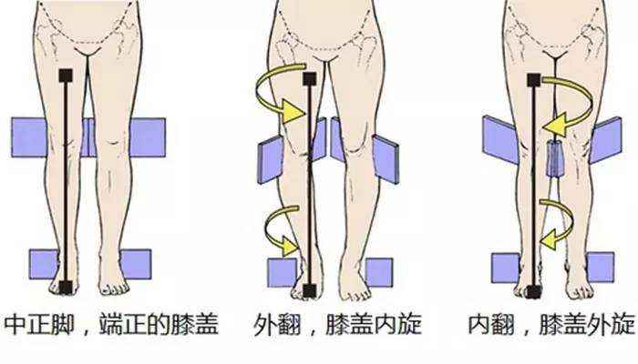 女生的腿哪样才算是最标准,女性腿粗的原因有哪些