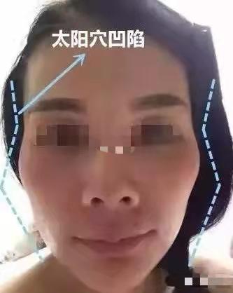 刻薄高颧骨面相,高颧骨到底是刻薄还是高级