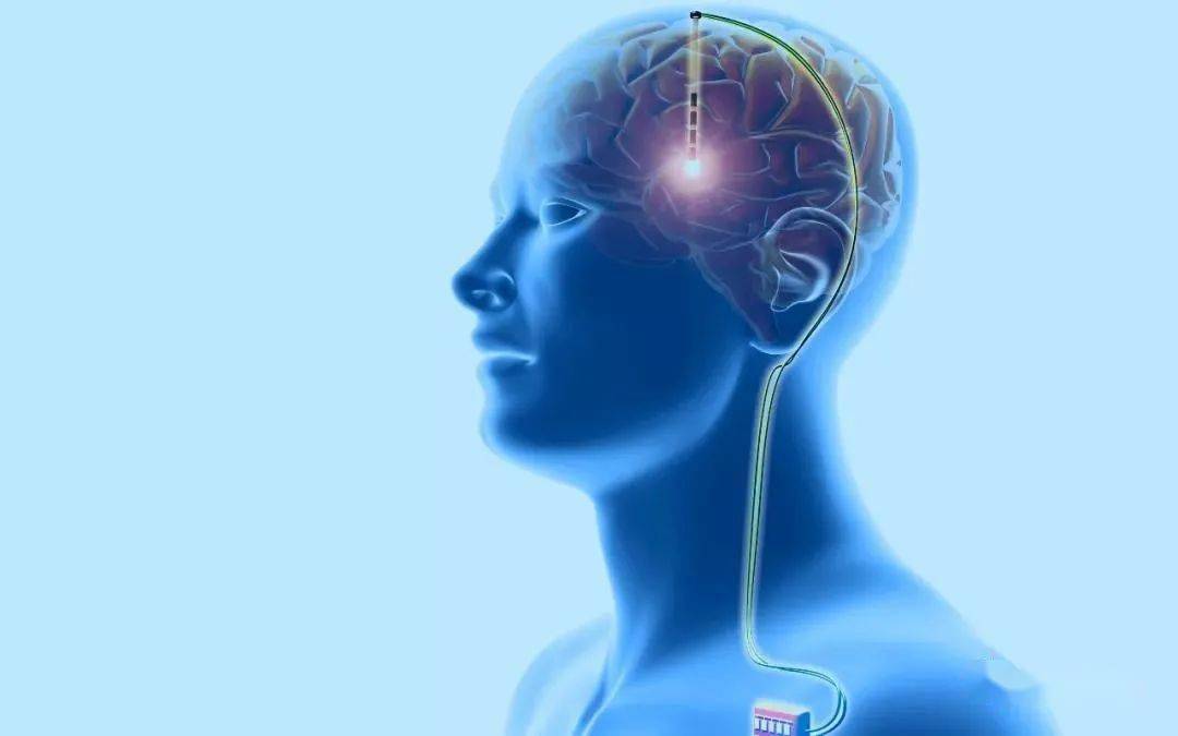 垂体前叶功能减退护理诊断及措施,垂体前叶功能减退症的诊疗流程图