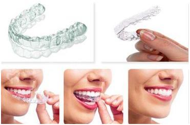 整牙期间怀孕会得牙周炎,怀孕期间能不能牙齿矫正