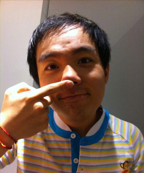 “三毛”34岁了！8岁爆火，14岁谢顶，植发挨300多针，如今变帅哥