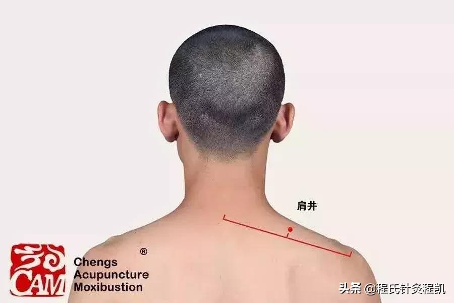 乳腺增生乳房胀痛怎么办,乳腺增生艾灸怎么治