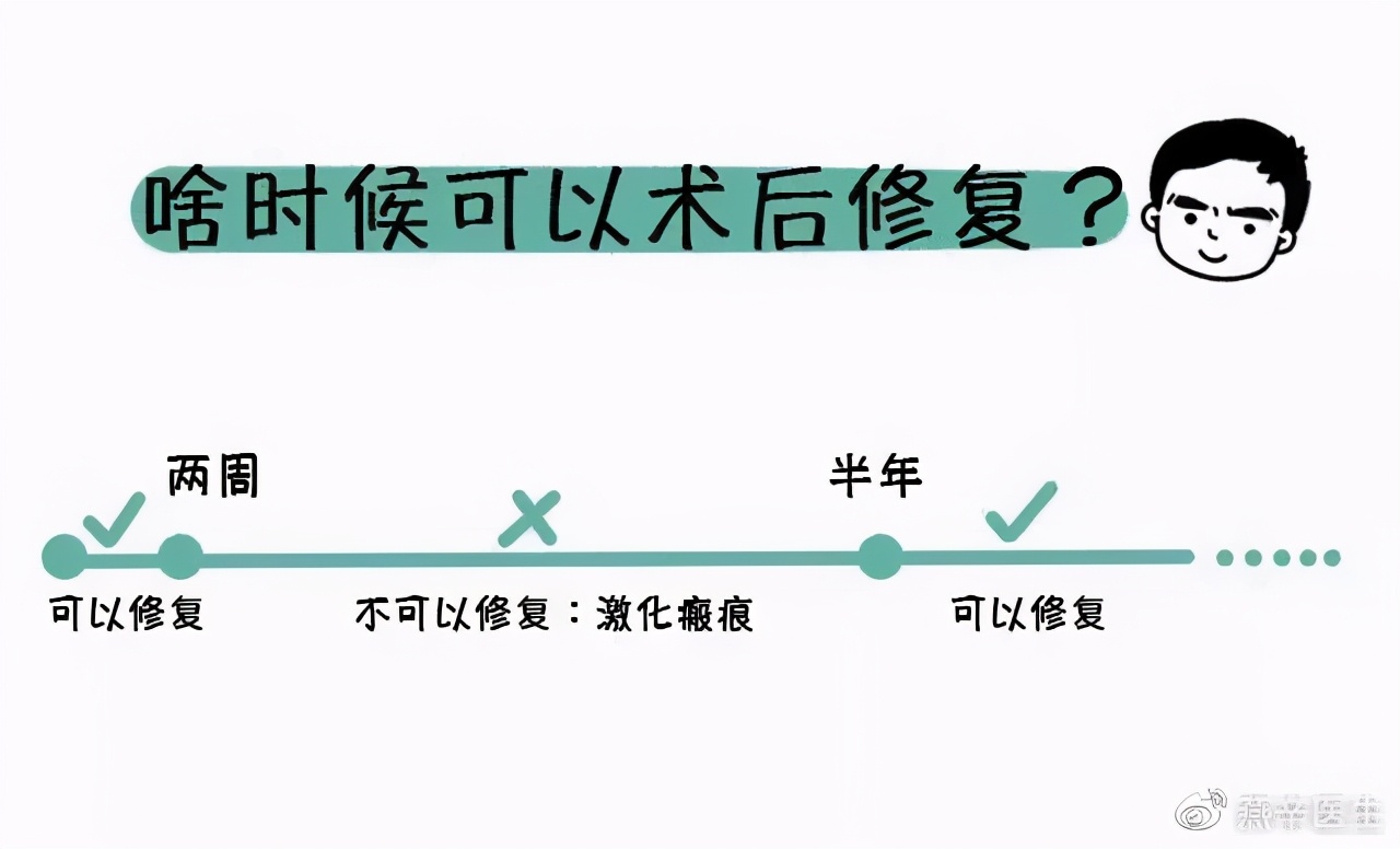 双眼皮修复科普,双眼皮修复要避免哪些坑