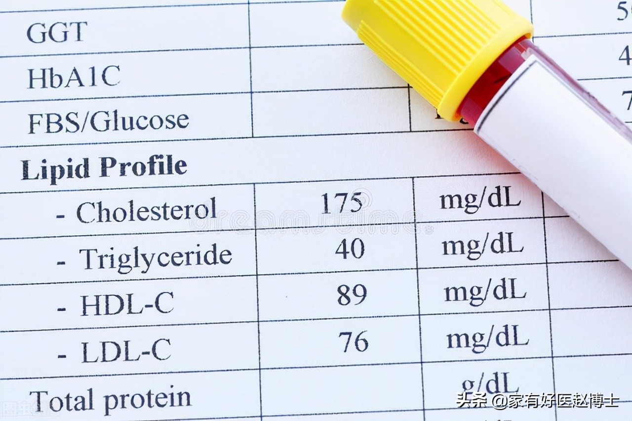 降胆固醇吃哪种他汀最好,降血脂他汀类的药物哪种最好