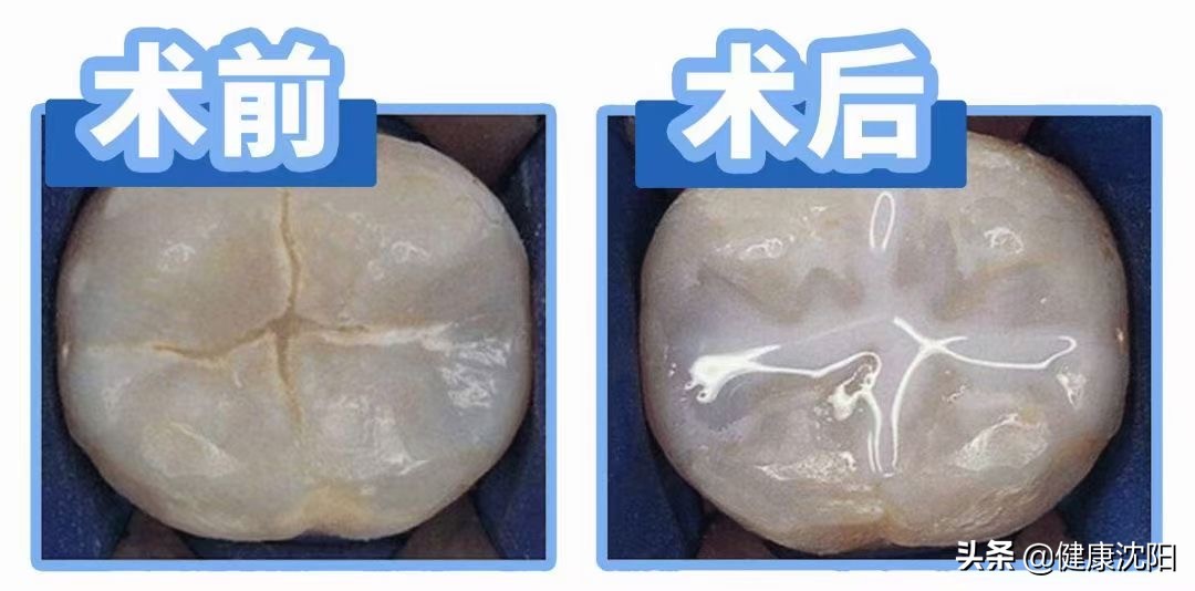 口腔科健康宣教科普视频,口腔医生科普口腔知识