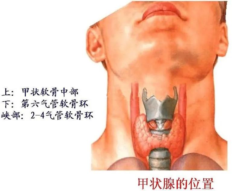可“治愈”的癌症-甲状腺乳头状癌