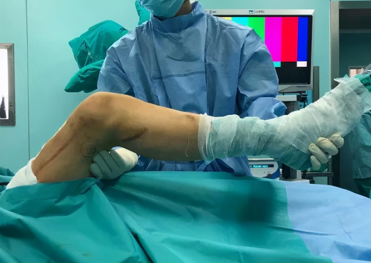 膝关节伸不直弯不了怎么回事,膝关节弯曲僵硬屈伸受限恢复