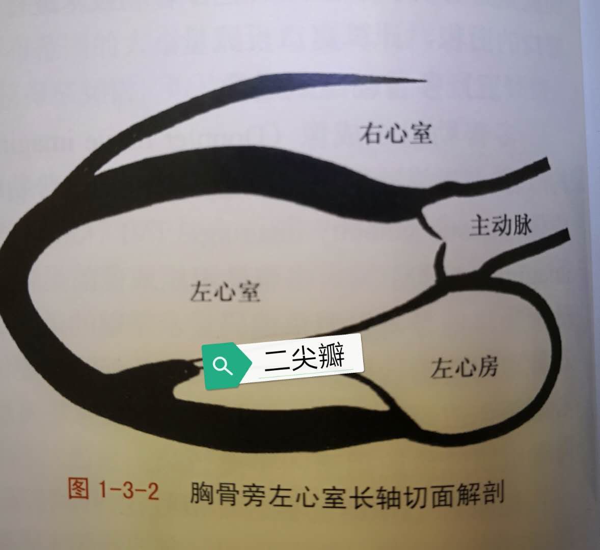 轻度三尖瓣二尖瓣返流是什么意思,二尖瓣及三尖瓣轻度返流什么意思