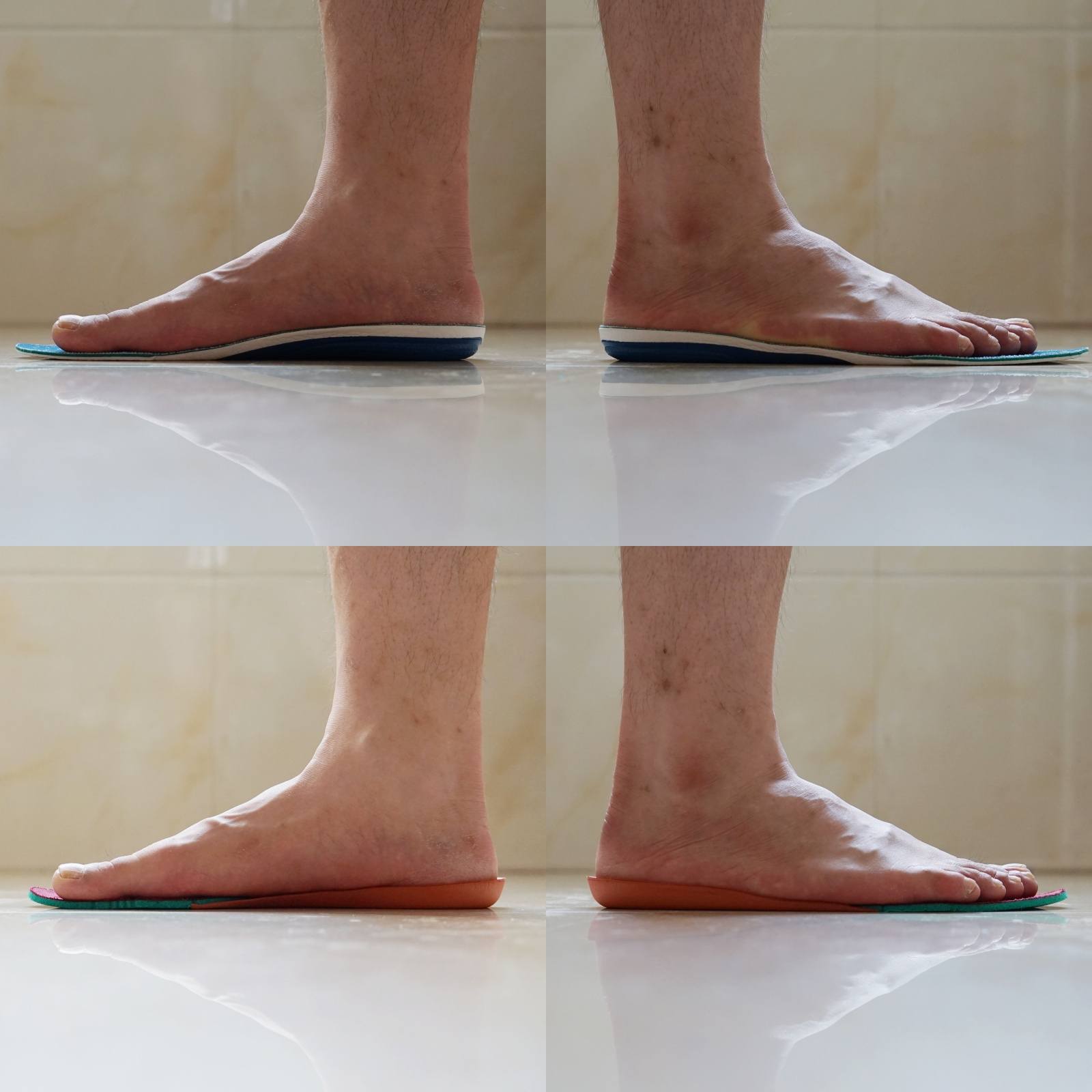 低足弓如何改善,足弓矫正鞋垫硬的好软的好