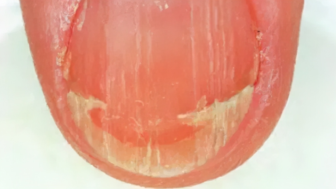 美甲的指甲怎么养护才好看,如何不做美甲就能让指甲变得精致