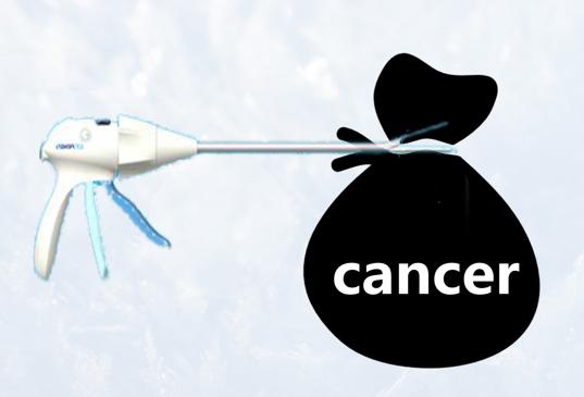 宫颈癌手术开腹好还是微创好,宫颈癌手术该做微创还是选开腹