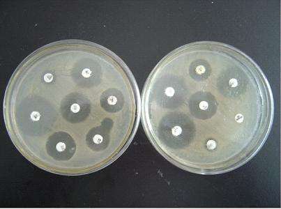 人得了猫癣怎么防止它越长越多 (猫病猫藓)