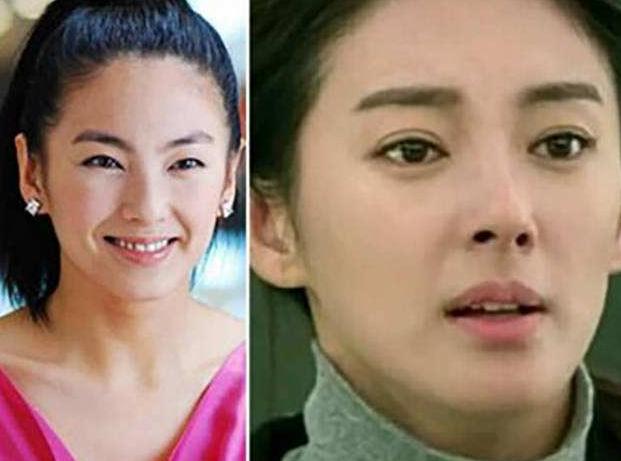 割双眼皮要怎样才知道合适自己,割过双眼皮和没割过双眼皮的区别