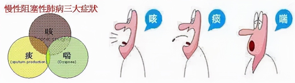 世界慢阻肺日的症状,慢性阻塞性肺炎正确的治疗措施