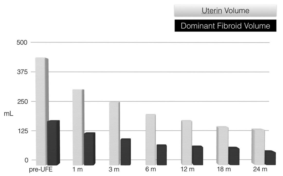 子宫肌瘤用介入栓塞会有后遗症吗,介入栓塞治疗子宫肌瘤多久消失
