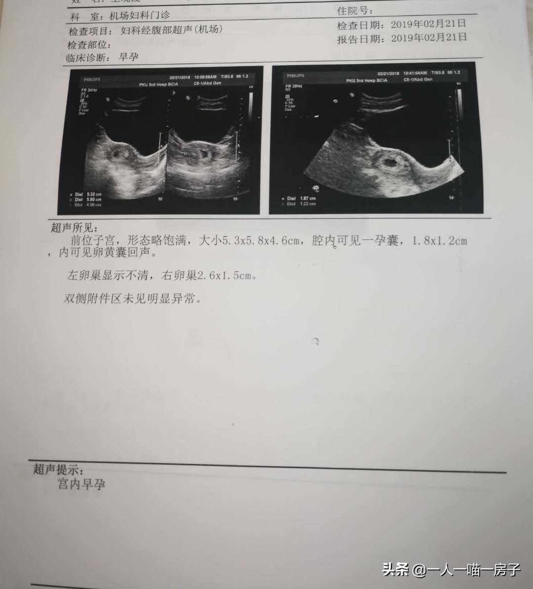 孕期日记：顺利通过无创DNA