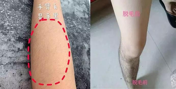 不做猕猴桃女孩是什么意思,不做猕猴桃女孩的图片