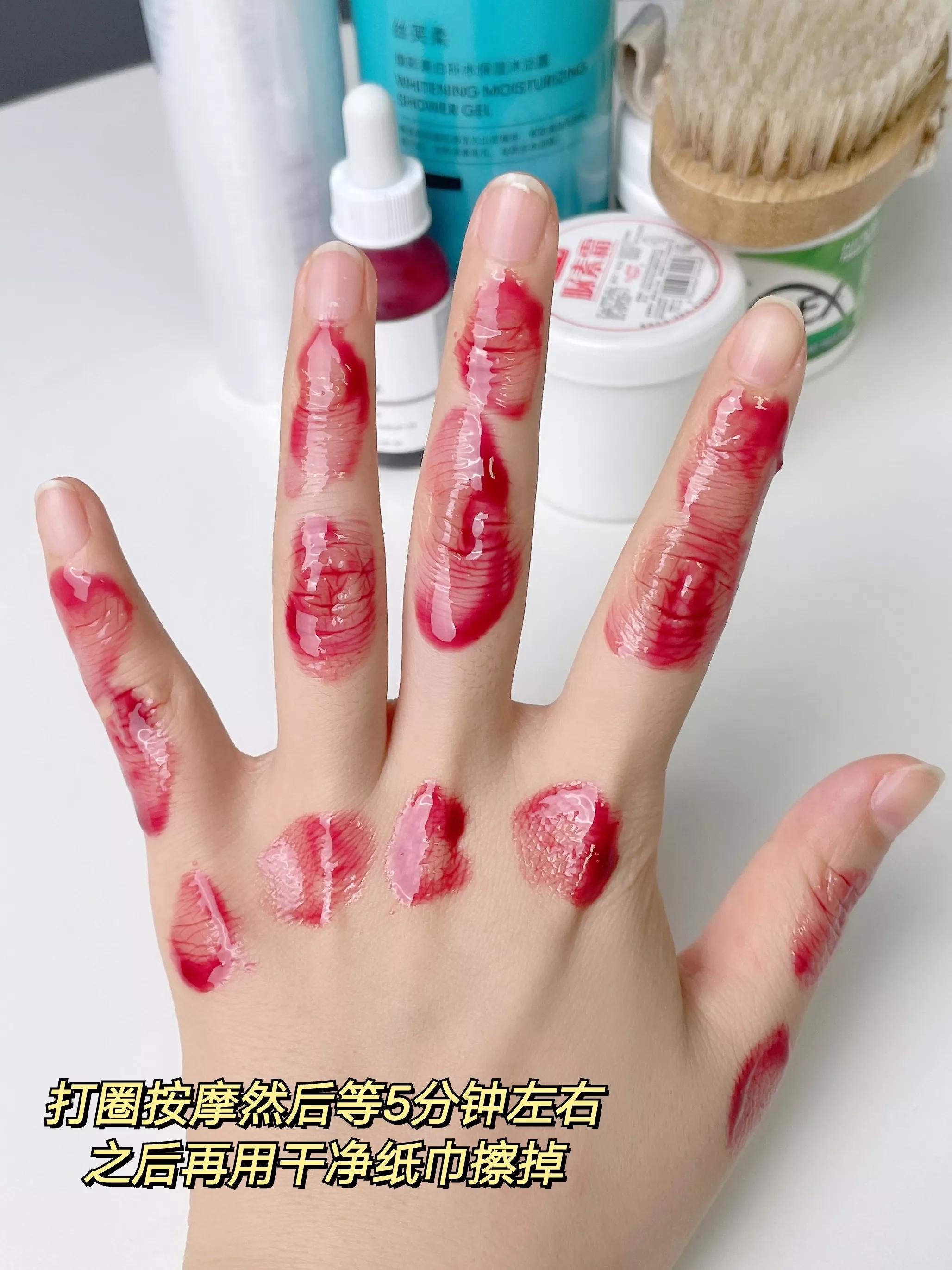 手部可以刷酸吗,手部刷酸可以变白吗