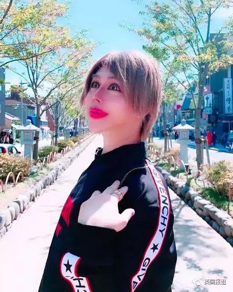 日本男子花费200万整容变成狗,日本整容小哥