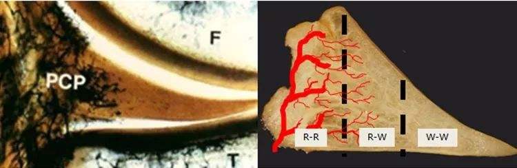 半月板被切除80%,半月板切除后还剩4分之一严重吗