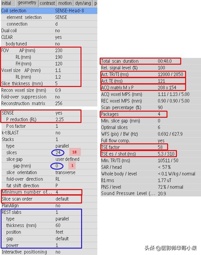 「MRI技术」磁共振伪影分析，了解下SSh_FLAIR序列