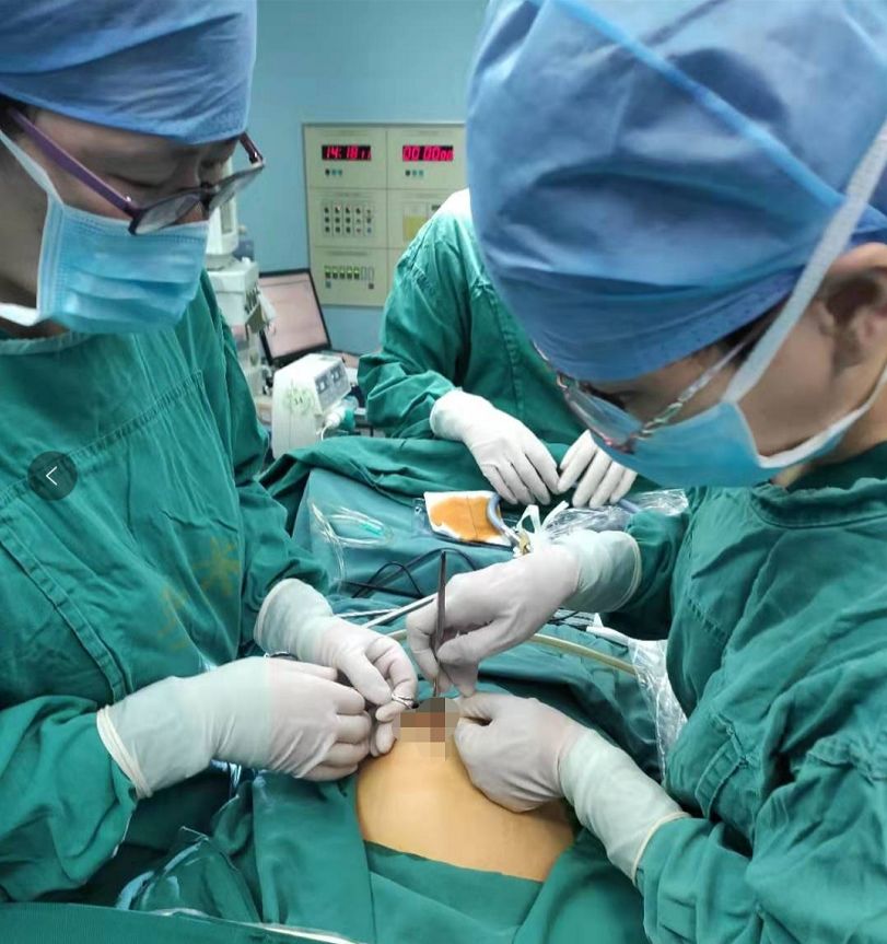 经脐单孔腹腔镜手术,经脐单孔腹腔镜子宫切除