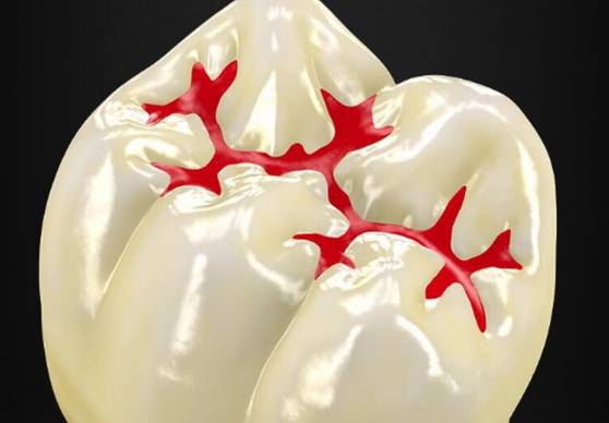 很多孩子家长不知道什么是六龄齿,很多家长以为六龄齿是乳牙