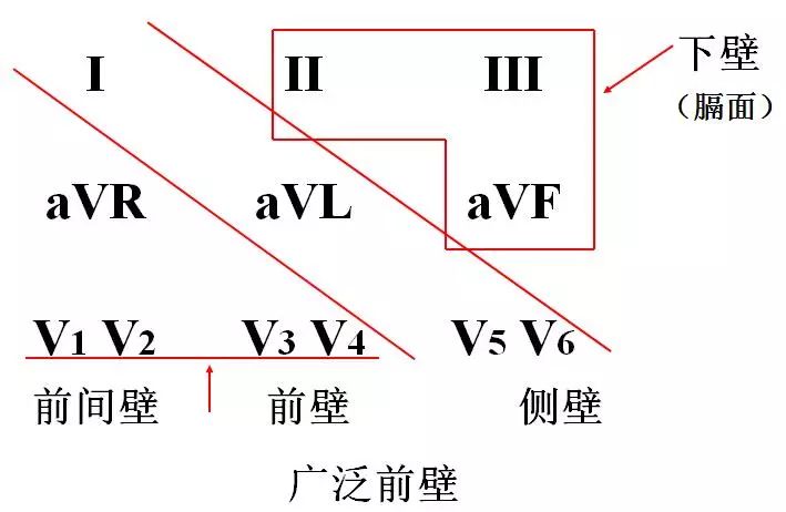 心律失常55分钟讲解,心律失常心电图讲解视频教程全集