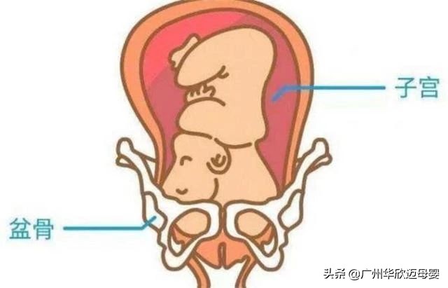 胎儿入盆是什么感觉?入盆要多久的时间,入盆后还要多久才能生?