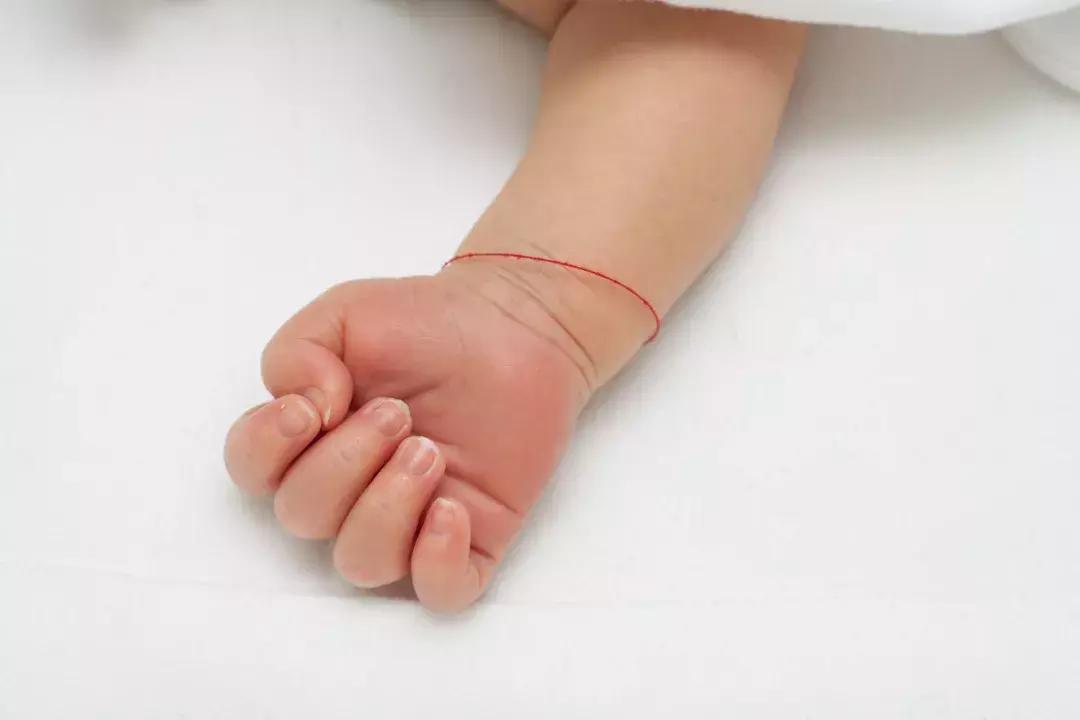 小孩用手抓破了怎么办,婴儿用手抓破脸