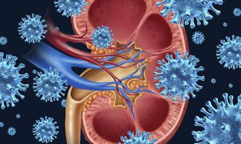 治疗iga肾病最好的医院,iga肾病治疗新进展