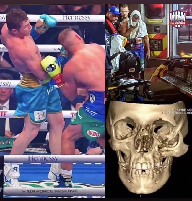 阿瓦雷兹重拳,阿瓦雷兹挨到重拳