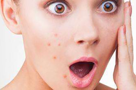 好用祛痘国货老品牌推荐,国货祛痘最好的牌子