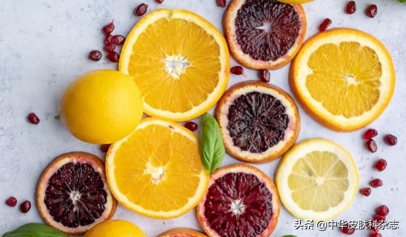 白癜风是一种遗传性的皮肤病吗,皮肤病白癜风是怎么回事